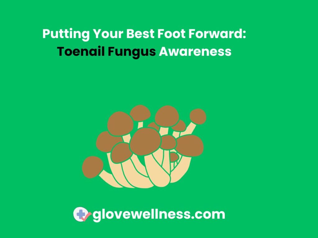 Putting Your Best Foot Forward Toenail Fungus Awareness