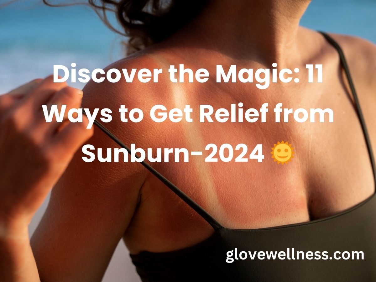 11 Ways to Get Relief from Sunburn-2024